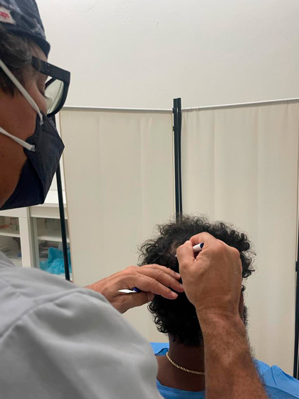 Clinica implantes capilares malaga